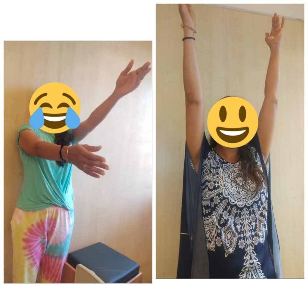 Patient Review Agnikarma Treatment